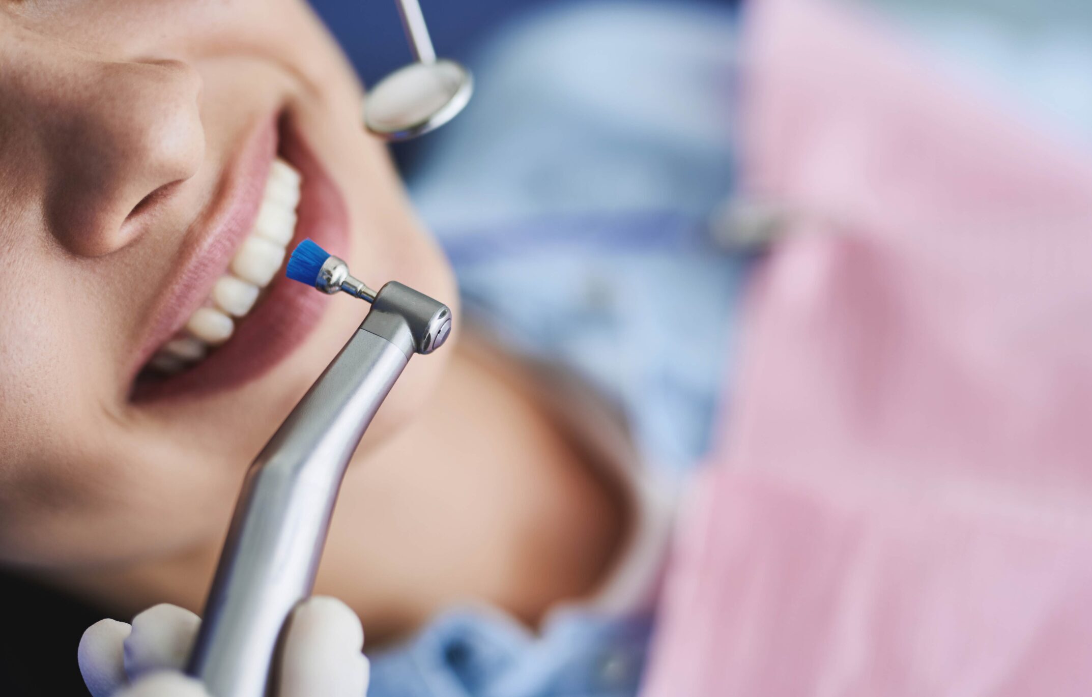 Pulizia dei denti: ogni quanto farla?