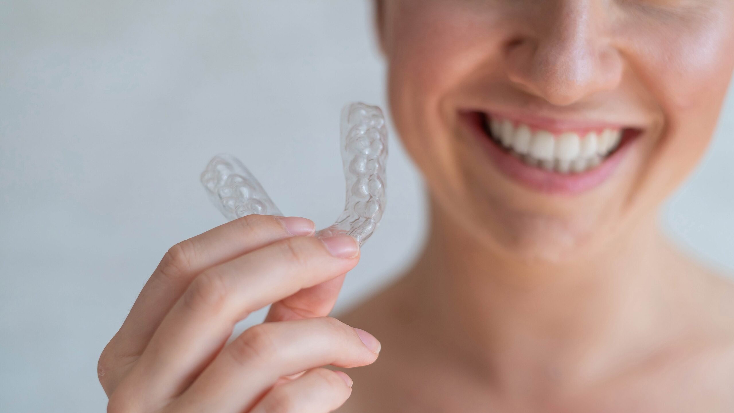 Contenzione dei denti